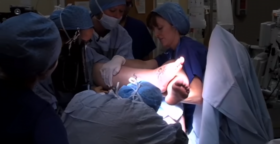 Nasterea cu ajutorul forcepsului. Cum se foloseste instrumentul pentru scoaterea copilului VIDEO | Demamici.ro