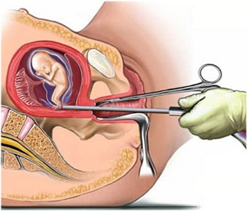 Medicii refuza sa mai faca avorturi la cerere in Postul Pastelui | Demamici.ro