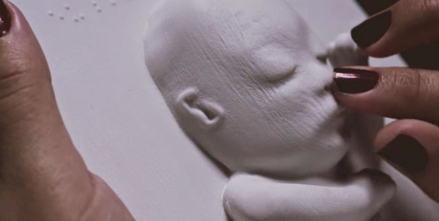 Viitoarea mamica era nevazatoare, iar doctorul a printat in 3D ecografia pentru ca mama sa-si poata "vedea" pentru prima data baietelul VIDEO | Demamici.ro